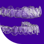 clear aligners